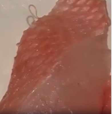 CLIENTE ENCONTRA VERME VIVO EM SASHIMI SEGUNDOS ANTES DE COMER E CASO VIRALIZA NA INTERNET